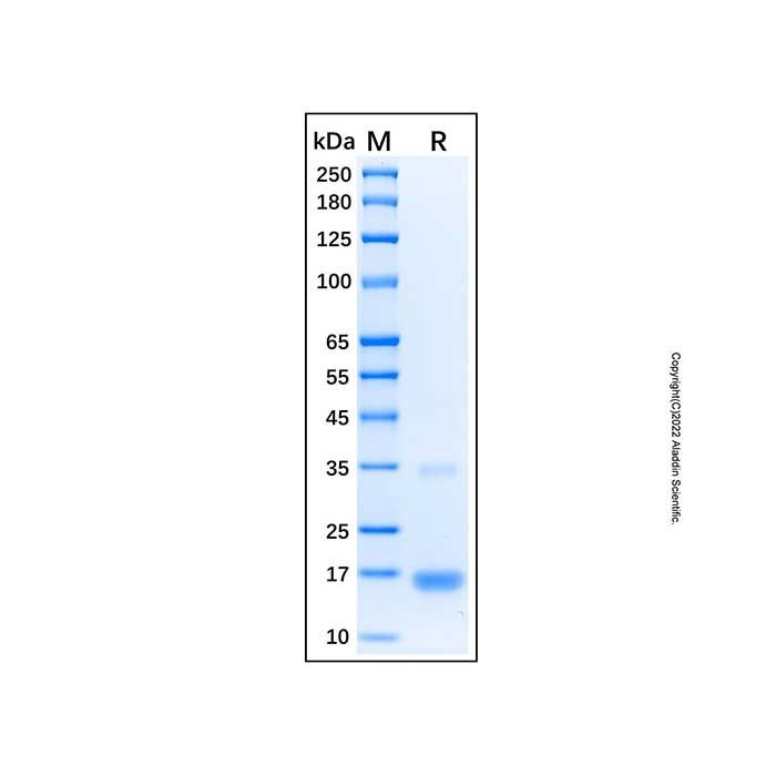 Recombinant Human BIM Protein -    by Aladdin Scientific