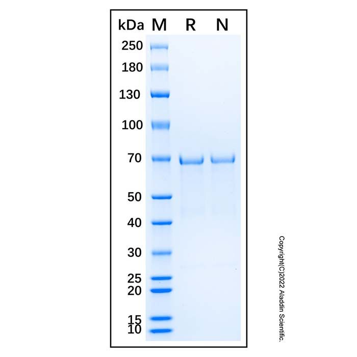 Recombinant Human AKT3 Protein -    by Aladdin Scientific