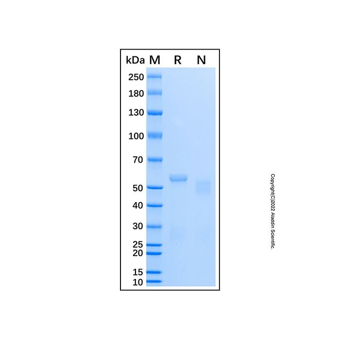 Recombinant Human ATM Protein -    by Aladdin Scientific