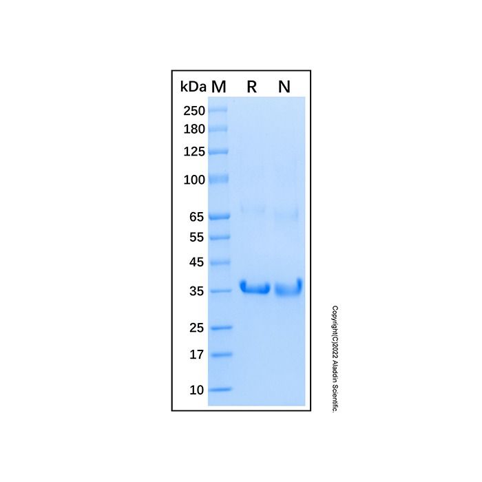 Recombinant Human FOXM1 Protein -    by Aladdin Scientific