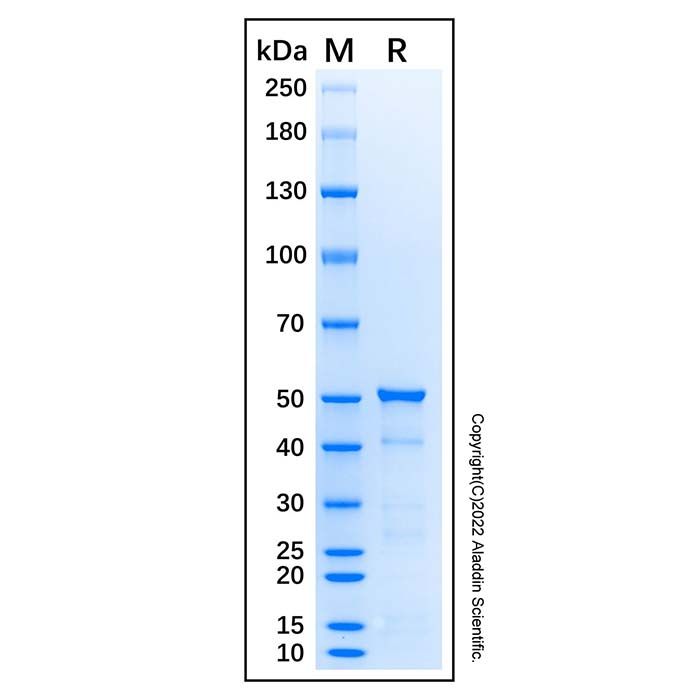 Recombinant Human HDAC3 Protein -    by Aladdin Scientific