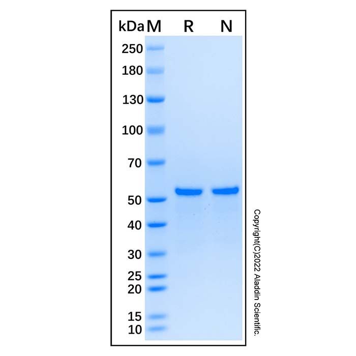 Recombinant Human IRS1 Protein -    rp184897 by Aladdin Scientific