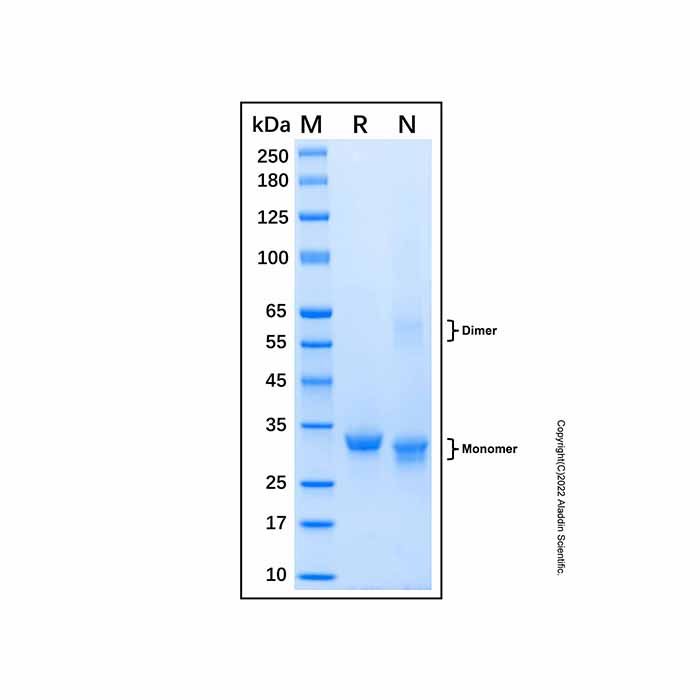 Recombinant Human Glycine N-methyltransferase/GNMT Protein -    by Aladdin Scientific
