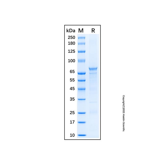 Recombinant Human Sirtuin 1/SIRT1 Protein -    by Aladdin Scientific