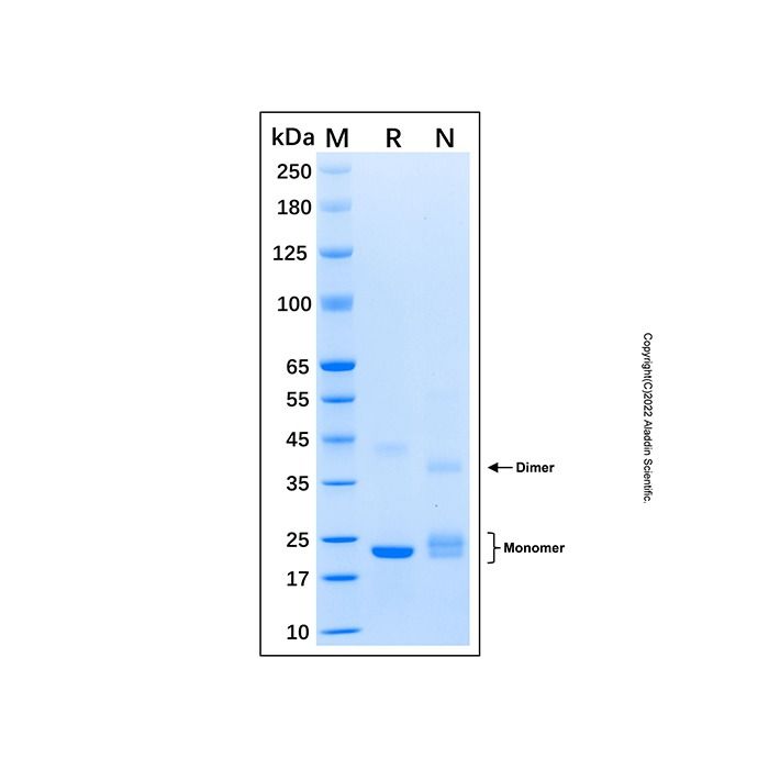 Recombinant Human USAG1 Protein -    by Aladdin Scientific