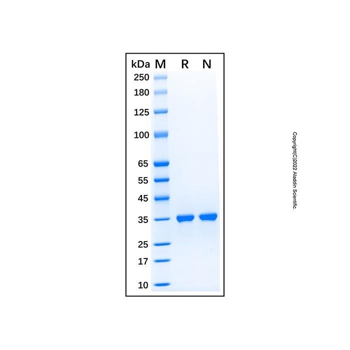 Recombinant Human SULT1E1 Protein -    by Aladdin Scientific