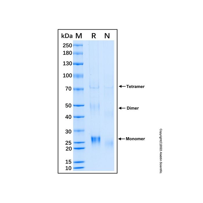 Recombinant Human Thymidine Kinase 1 Protein -    by Aladdin Scientific