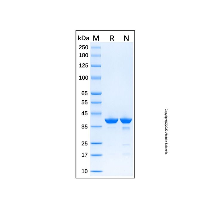Recombinant Human ERK2 Protein -    by Aladdin Scientific