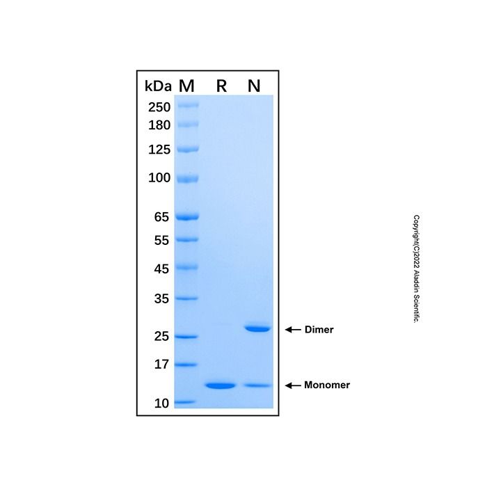 Recombinant Rat IFN-gamma Protein -    by Aladdin Scientific
