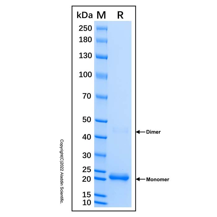 Recombinant Human RIPK3 Protein -    by Aladdin Scientific