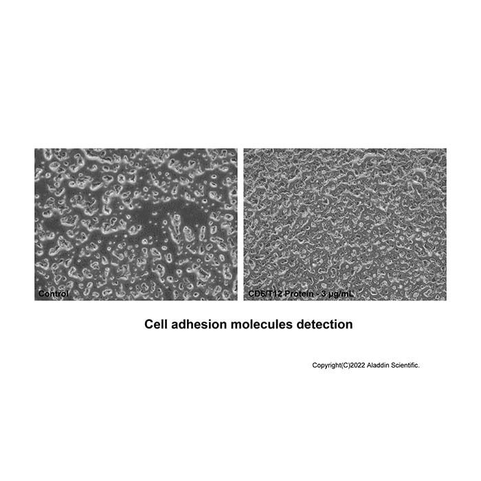 Recombinant Human CD6 Protein -    by Aladdin Scientific
