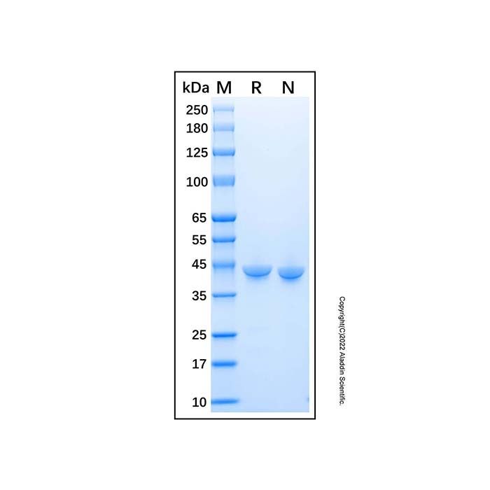 Recombinant Human Carboxypeptidase A1/CPA1 Protein -    by Aladdin Scientific