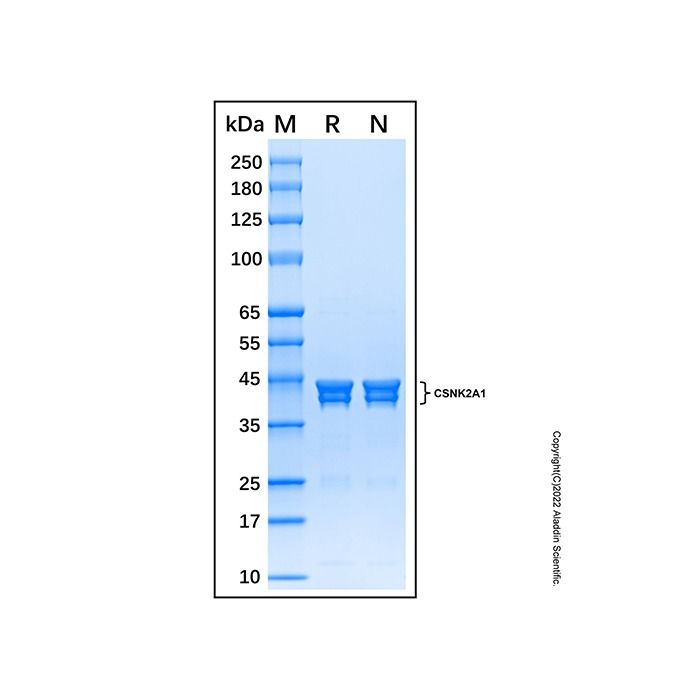 Recombinant Human Casein Kinase 2 alpha Protein -    by Aladdin Scientific