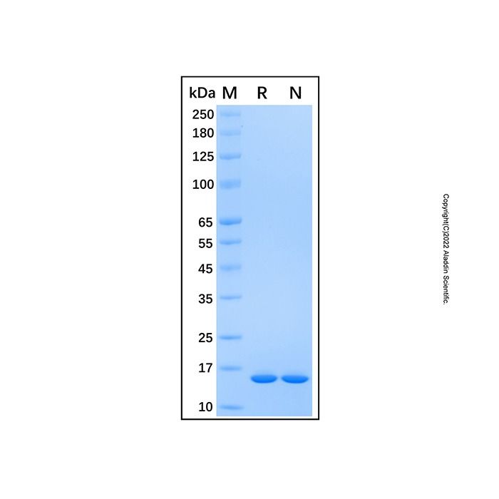 Recombinant Human GABARAP Protein -    by Aladdin Scientific