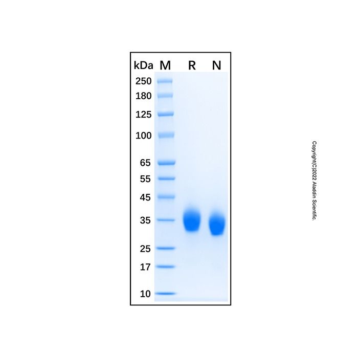 Recombinant Human CEACAM-21 Protein -    by Aladdin Scientific