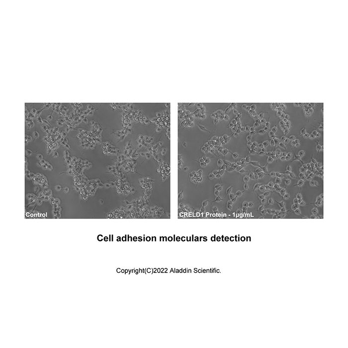 Recombinant Human CRELD1 Protein -    rp188299 by Aladdin Scientific