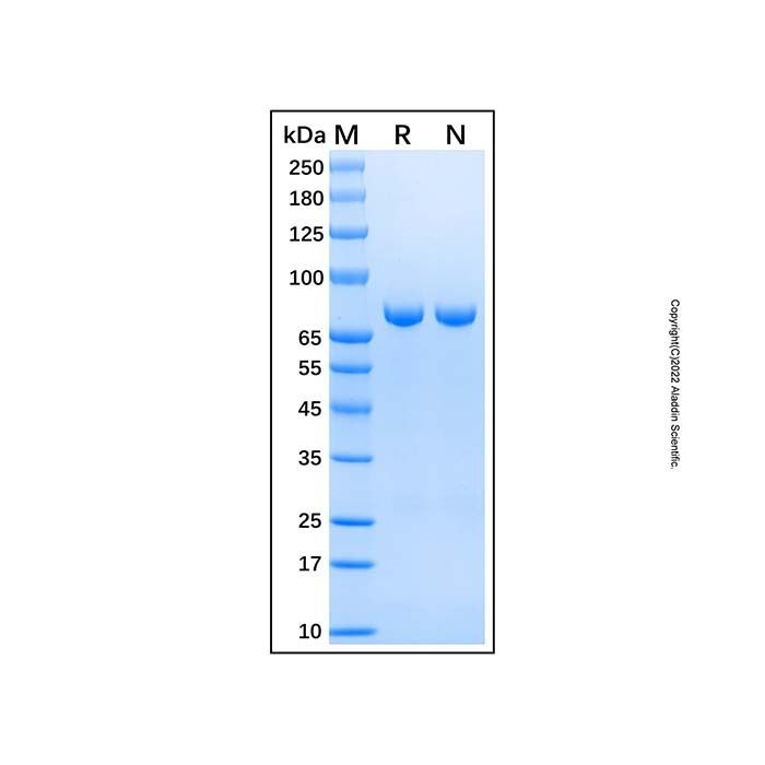 Recombinant Human DPP3 Protein -    by Aladdin Scientific