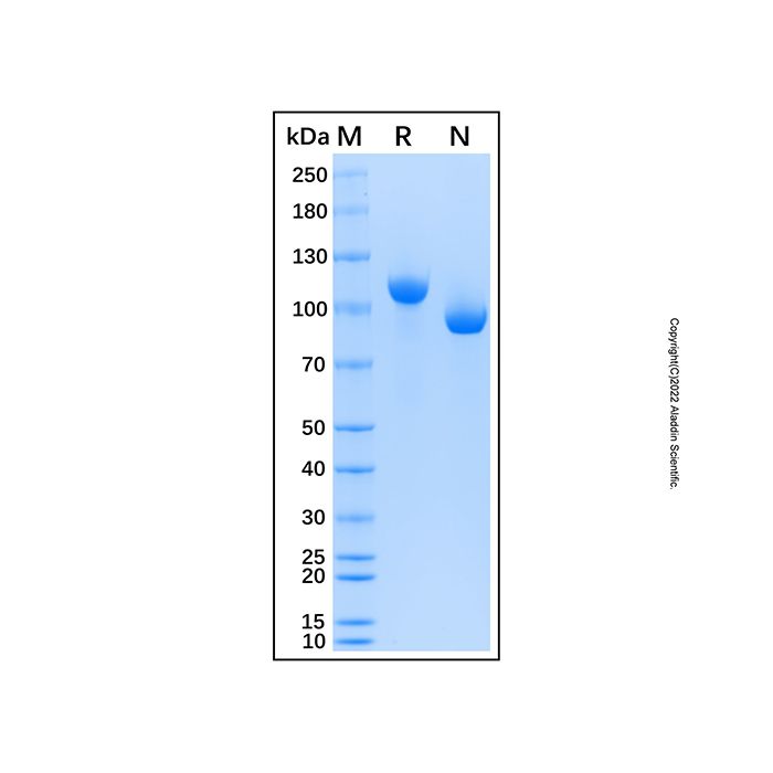 Recombinant Human C6 Protein -    by Aladdin Scientific