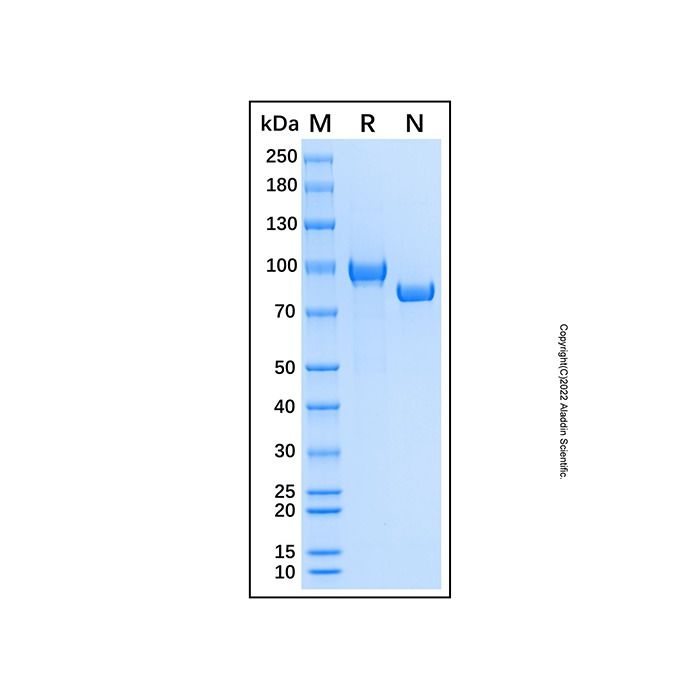 Recombinant Human Complement C7 Protein -    by Aladdin Scientific