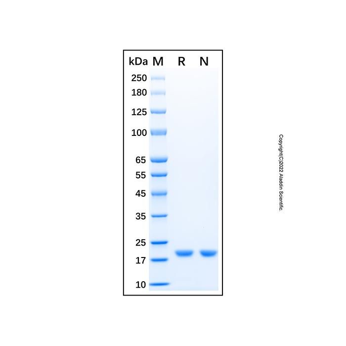 Recombinant Human Cofilin 2 Protein -    by Aladdin Scientific