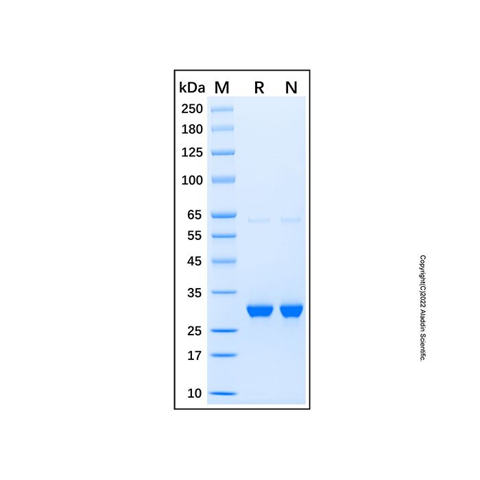 Recombinant Human DCK Protein -    by Aladdin Scientific