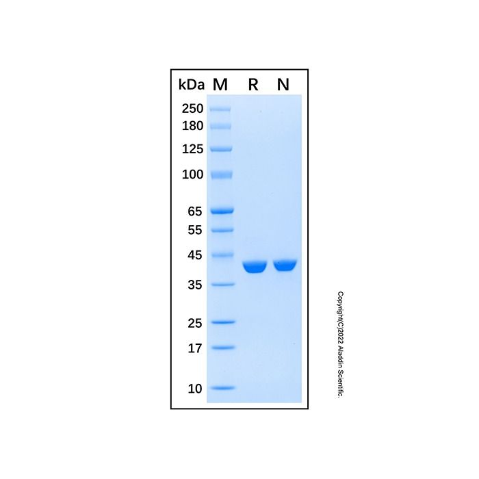 Recombinant Human GFPT1 Protein -    by Aladdin Scientific