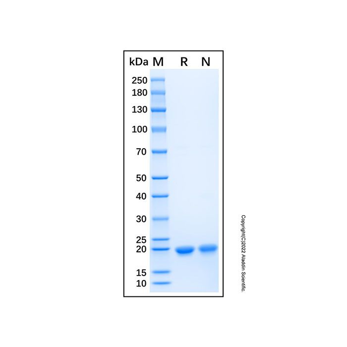Recombinant Human PTPMT1 Protein -    by Aladdin Scientific
