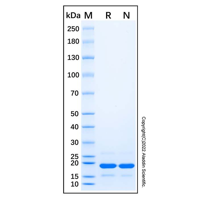 Recombinant Retinoblastoma-associated/RB1 Protein -    by Aladdin Scientific