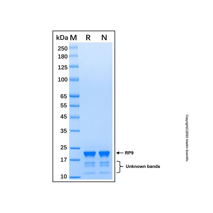 Recombinant Human RP9 Protein -    by Aladdin Scientific