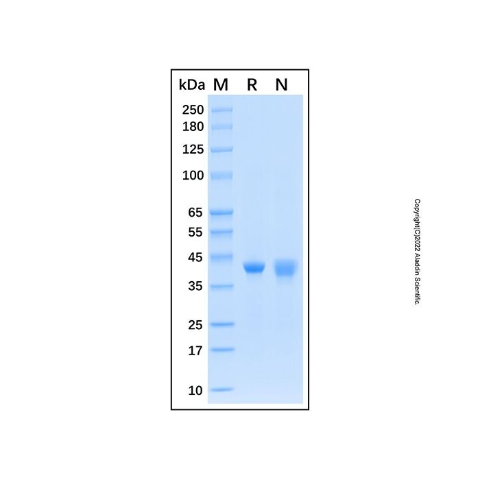 Recombinant Human SAE1 Protein -    by Aladdin Scientific