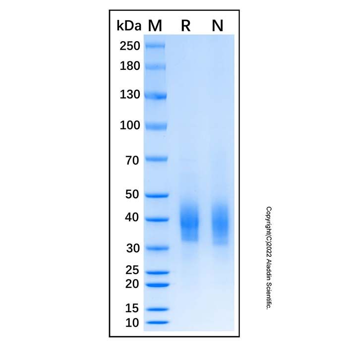 Recombinant Human Cerberus 1 Protein -    rp188444 by Aladdin Scientific