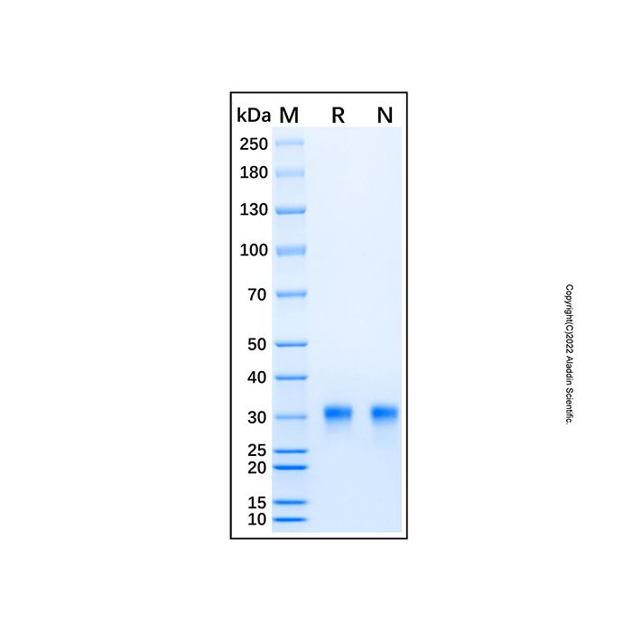 Recombinant Human Chondrolectin Protein  -    by Aladdin Scientific