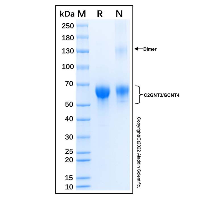 Recombinant Human C2GNT3/GCNT4 Protein -    by Aladdin Scientific