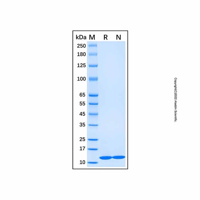 Recombinant Human CKS2 Protein -    by Aladdin Scientific