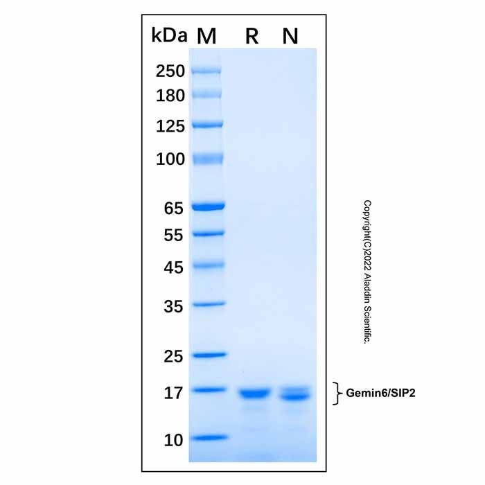 Recombinant Human Gemin6/SIP2 Protein -    by Aladdin Scientific