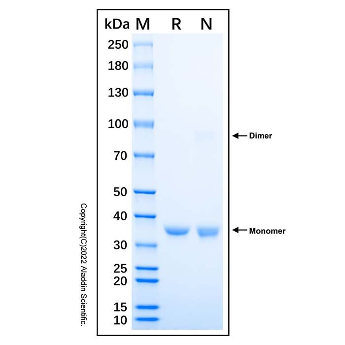Recombinant Human PTGR1 Protein -    by Aladdin Scientific