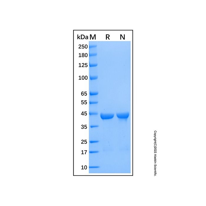 Recombinant Human YOD1 Protein -    by Aladdin Scientific