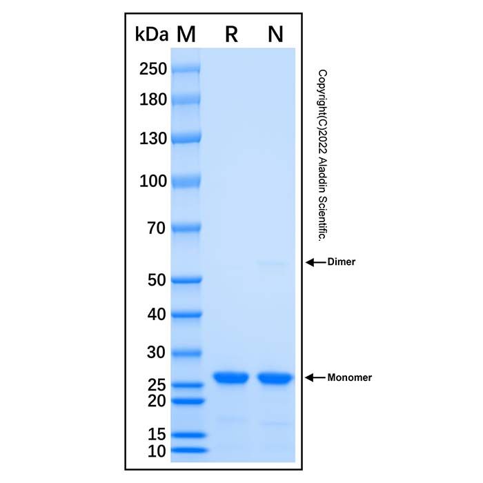 Recombinant Human ARHGDIB Protein -    by Aladdin Scientific