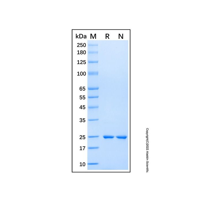 Recombinant Human CAPSL Protein -    by Aladdin Scientific