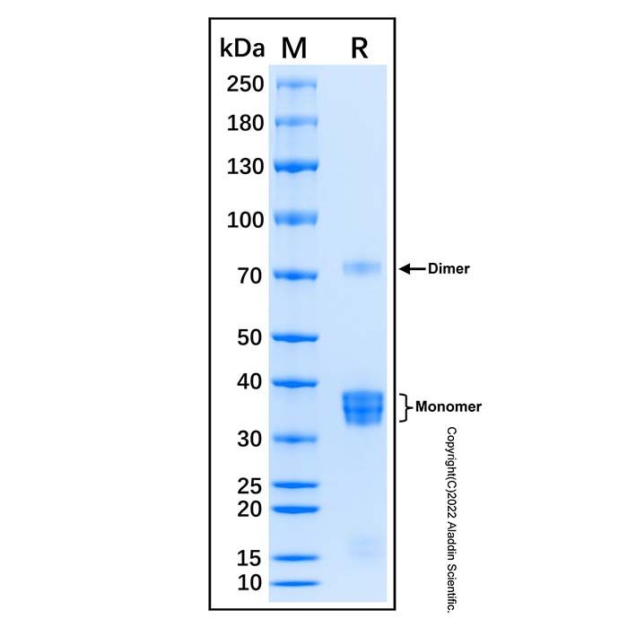 Recombinant Human CCDC69 Protein -    by Aladdin Scientific