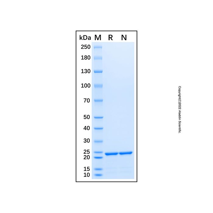 Recombinant Human CCDC90B Protein  -    by Aladdin Scientific