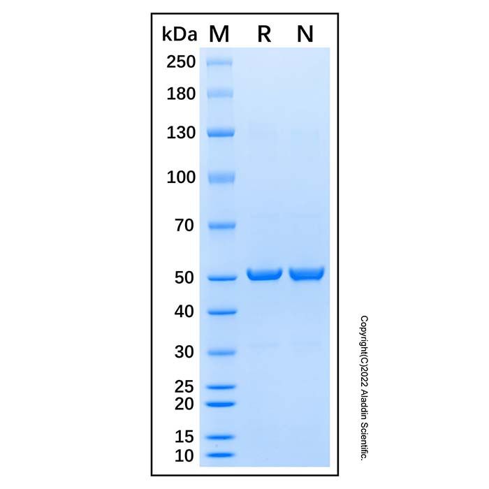Recombinant Human Cyclin A2/CCNA2 Protein -    rp189294 by Aladdin Scientific