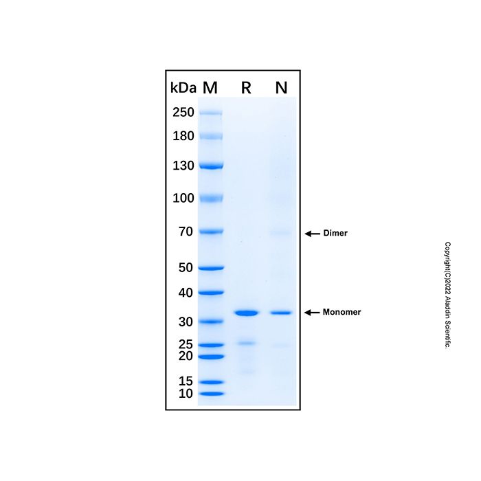Recombinant Human CENPU Protein -    rp189311 by Aladdin Scientific