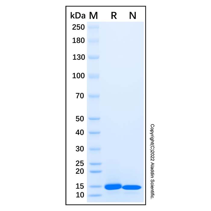 Recombinant Human CHCHD7 Protein -    by Aladdin Scientific