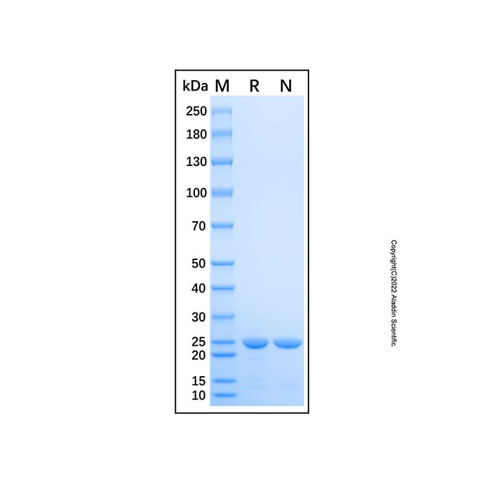 Recombinant Human CHP1 Protein -    by Aladdin Scientific