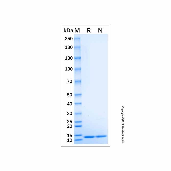 Recombinant Human CNN2 Protein -    by Aladdin Scientific