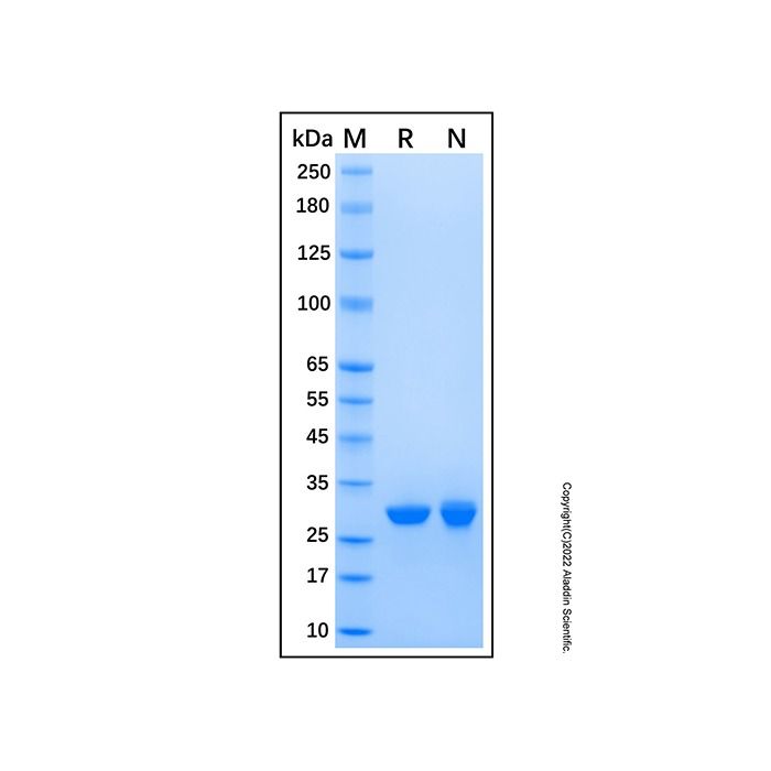 Recombinant Human RQCD1 Protein -    by Aladdin Scientific