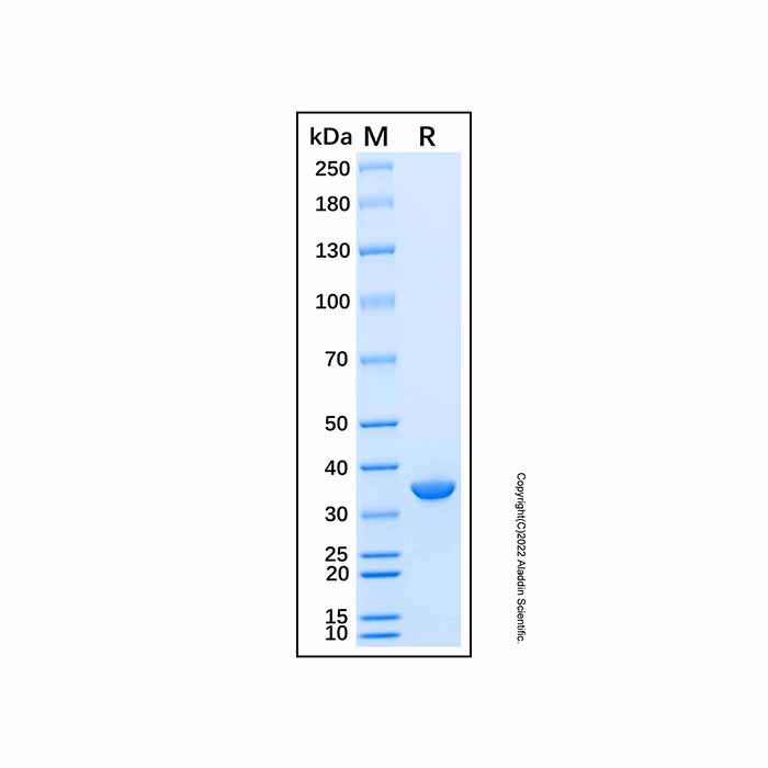 Recombinant Human CRYM Protein -    by Aladdin Scientific