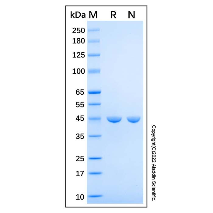 Recombinant Human CUL1 Protein -    by Aladdin Scientific