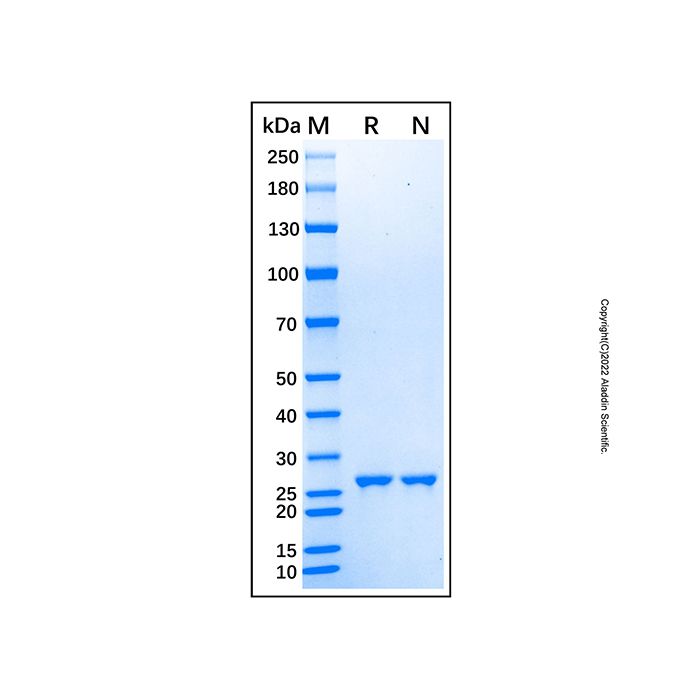 Recombinant Human DGCR6 Protein -    by Aladdin Scientific